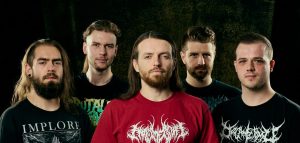 Stillbirth band