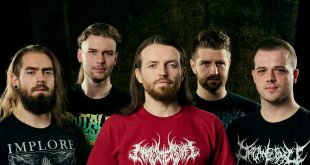 Stillbirth band